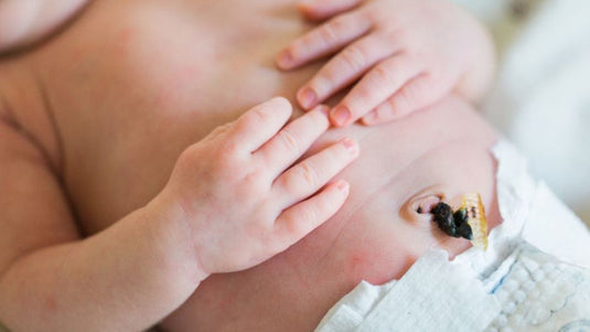 cuidado-cicatrizacion-cordon-umbilical-funciones-higiene