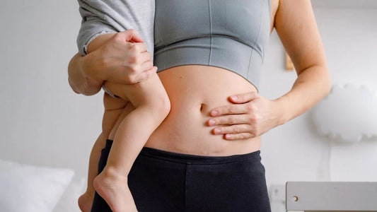 parto-cesarea-procedimiento-recuperacion-nacimiento